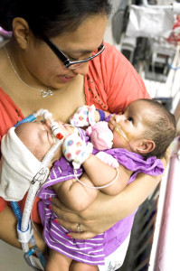 美國德州一對去年出世的胸腔及腹部相連的雙胞胎女嬰，本月初接受26小時的複雜手術後，分割成功，創下全球首例。《每日郵報》報導，女嬰娜塔莉（Knatalye Hope Mata）與艾德琳（Adeline Faith Mata），共用肺、肝臟、橫隔膜、盆骨、腸道及心血管，去年4月11日出生以來一直留在德州兒童醫院加護病房。經過半年觀察，醫生認為她們適合接受分割手術，花一個多月伸展她們的皮膚，以縫補手術造成的大傷口。p1045-a6-02