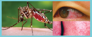 病媒斑蚊，引發結膜炎（紅眼)，引發丘疹p1094-a1-06