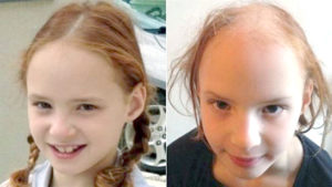 美國一名女童勞倫斯（Eliana Lawrence）使用祖母送的洗髮乳洗頭，使用三次之後不只頭髮幾乎全禿，甚至連眉毛及眼睫毛也掉光。p1127-a6-03